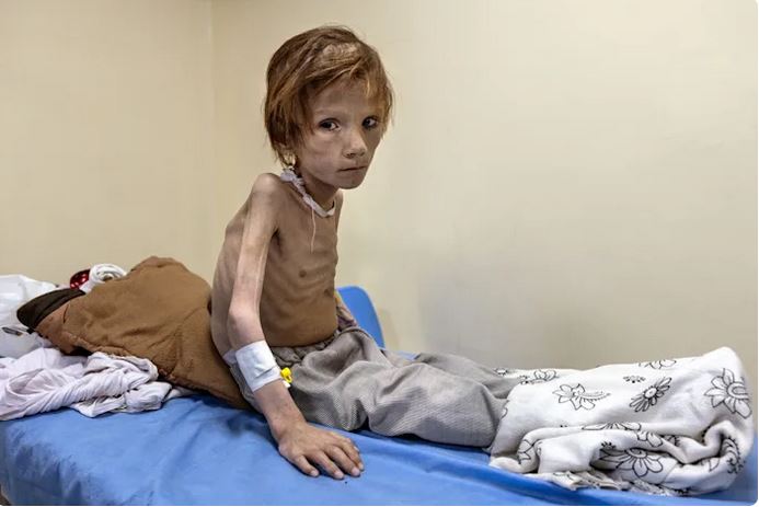 Rukia Jan sits in the emergency room at the Indira Ghandi Children’s Hospital in Kabul 