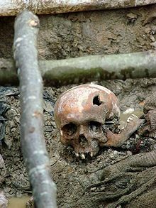 Skull of a victim of the July 1995 Srebrenica massacre. Exhumed mass grave outside the village of Potočari, Bosnia and Herzegovina. July 2007.